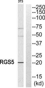 RGS5 rabbit pAb Antibody