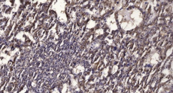 Rab 2B antibody