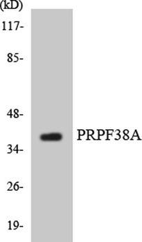 PRPF38A rabbit pAb