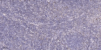 PRPF38A antibody