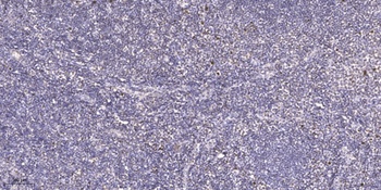 PRPF38A rabbit pAb