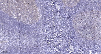 RELT antibody