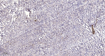 MYPT3 antibody