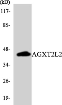 AGXT2L2 rabbit pAb