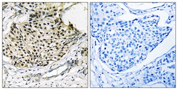 IKK gamma (phospho-Ser31) antibody