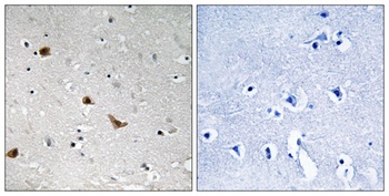 IKKγ (phospho Ser376) rabbit pAb