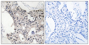 BAGE4 rabbit pAb Antibody