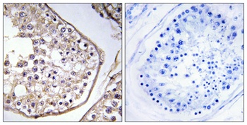 BAGE3 rabbit pAb Antibody