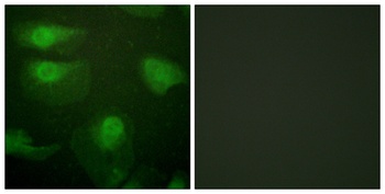 CaMKI alpha (phospho-Thr177) antibody