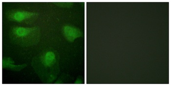 CaMKIα (phospho Thr177) rabbit pAb