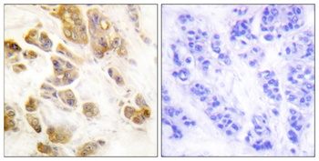 CaMKIα (phospho Thr177) rabbit pAb