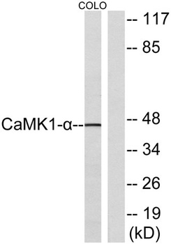 CaMKI alpha antibody