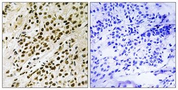 PRAK (phospho Thr182) rabbit pAb
