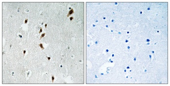 Mnk1 (phospho-Thr385) antibody