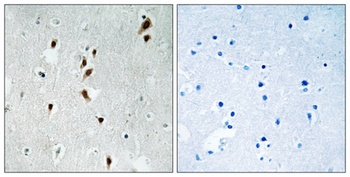 Mnk1 (phospho Thr385) rabbit pAb