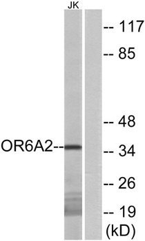 Olfactory receptor 6A2 rabbit pAb Antibody