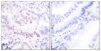 RUNX1 (phospho Ser276) rabbit pAb