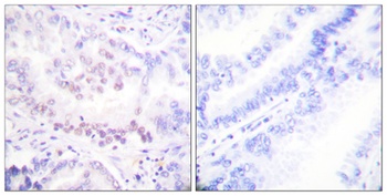 RUNX1 (phospho-Ser276) antibody