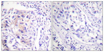 Cbl (phospho Tyr774) rabbit pAb