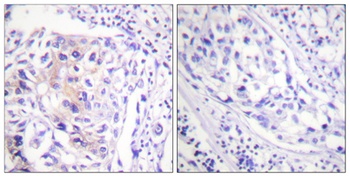 Cbl (phospho-Tyr774) antibody