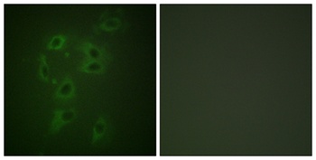 Cbl (phospho-Tyr700) antibody