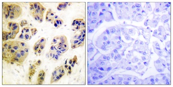 Cbl (phospho Tyr700) rabbit pAb