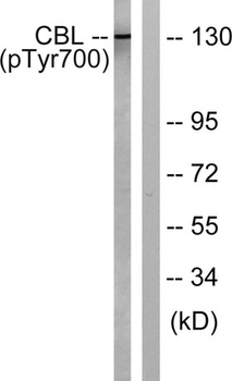 Cbl (phospho-Tyr700) antibody