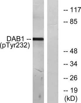 Dab1 (phospho Tyr232) rabbit pAb