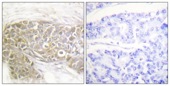 PEA-15 antibody