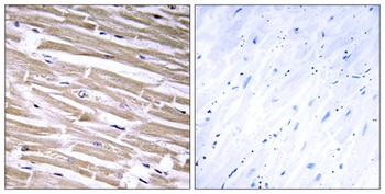 beta-1,3-Gal-T2 antibody