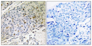 RMP antibody