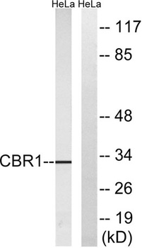 Carbonyl Reductase 1 rabbit pAb