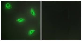 LIGHT rabbit pAb Antibody