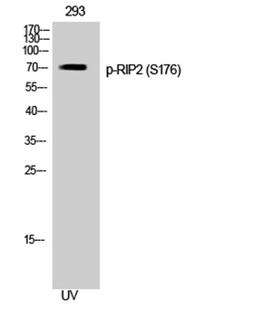 RIP2 (phospho-Ser176) antibody