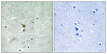 RIP2 (phospho Ser176) rabbit pAb