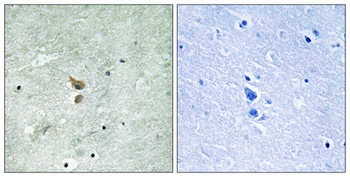 RIP2 (phospho-Ser176) antibody