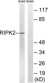 RIP2 antibody