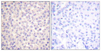 FADD (phospho Ser194) rabbit pAb