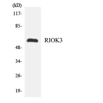 SUDD antibody