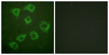 Ksr-1 rabbit pAb Antibody