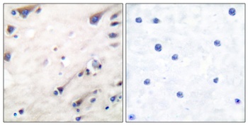 Ksr-1 rabbit pAb Antibody