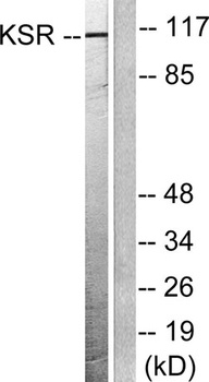 Ksr-1 rabbit pAb Antibody