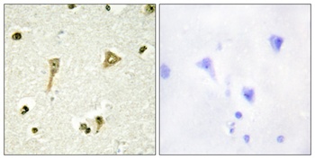 TSC-22 rabbit pAb