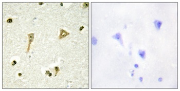 TSC-22 antibody