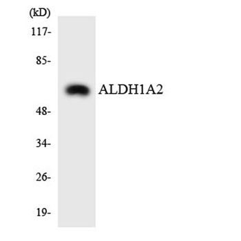 ALDH1A2 rabbit pAb