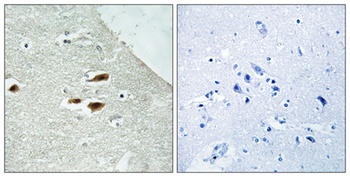 Per2 (phospho Ser662) rabbit pAb