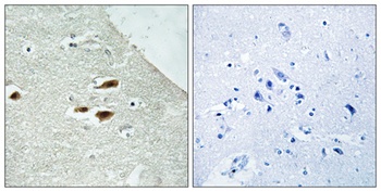 Per2 (phospho-Ser662) antibody