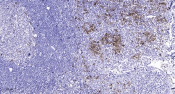 PIXbeta antibody