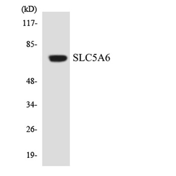 SMVT antibody