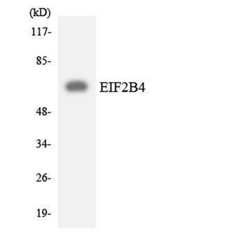 eIF2Bδ rabbit pAb Antibody